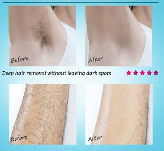 Original Ecrin Hair Removal Spray Official Website