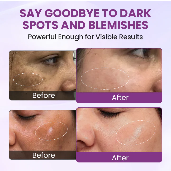 RadiantClear Blemish & Brightening Serum