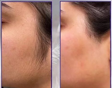 Original Ecrin Hair Removal Spray Official Website