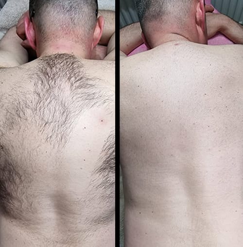 Original Ecrin Hair Removal Spray Official Website