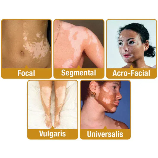 New Revitalizing Bee Venom Cream – Natural Skin Restoration & Vitality